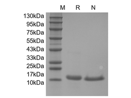 IL-21, human recombinant protein