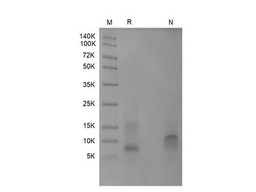 Recombinant Human NAP-2/CXCL7