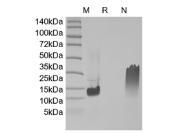Recombinant Human Eotaxin-3/CCL26