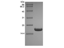 Recombinant Human UBE2B, His