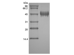Recombinant Human PEDF