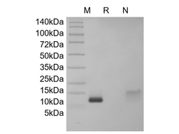 Recombinant Human DES1-3 IGF-1