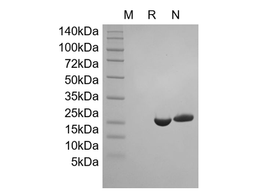 Recombinant Human Interleukin-1 Receptor Antagonist Protein