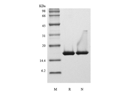 Recombinant Human Interleukin-36 beta, 153a.a.