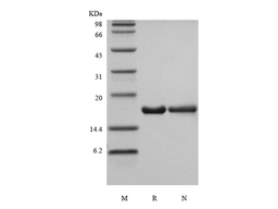Recombinant Human Interleukin-36 Receptor Antagonist Protein