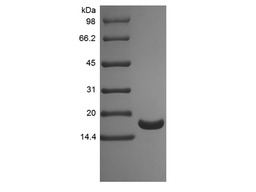 Recombinant Human Tumor Necrosis Factor-alpha/TNFSF2, His