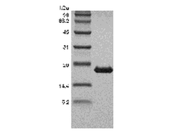 Recombinant Human Tumor Necrosis Factor-beta/TNFSF1