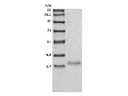Recombinant Human TNF-related Weak Inducer of Apoptosis Receptor/TNFRSF12A