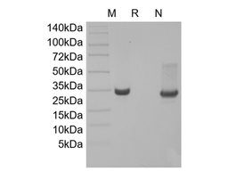 Recombinant Human 4-1BB Receptor/TNFRSF9