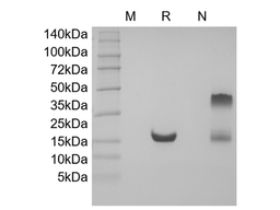 Recombinant Human soluble Tumor Necrosis Factor-Related Apoptosis-inducing Ligand Receptor-2/TNFRSF10B