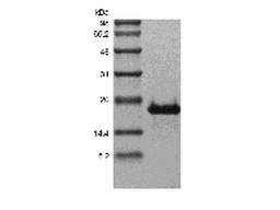 Recombinant Human Transmembrane Activator and CAML Interactor/TNFRSF13B