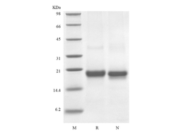 Recombinant Human soluble Fas Receptor/TNFRSF6