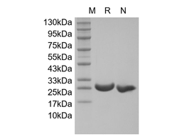 Recombinant Human soluble Receptor Activator of Nuclear Factor kappa-B Receptor/TNFRSF11A