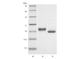 Recombinant Human soluble Tumor Necrosis Factor Receptor Type I/TNFRSF1A