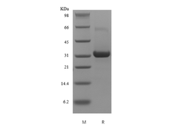 Recombinant Human Insulin-like Growth Factor-Binding Protein 5