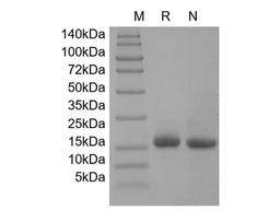 Recombinant Human Glia Maturation Factor beta