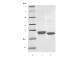 Recombinant Human Mesencephalic Astrocyte-Derived Neurotrophic Factor