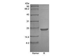 Recombinant Murine Mesencephalic Astrocyte-Derived Neurotrophic Factor