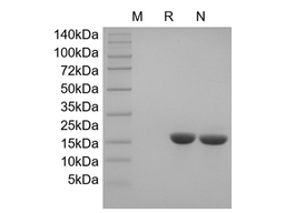 Recombinant Murine Cerebral Dopamine Neurotrophic Factor