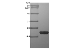 Recombinant Rat Glia Maturation Factor beta
