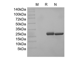 Recombinant Rat Cerebral Dopamine Neurotrophic Factor