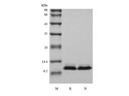 Recombinant Human NT-pro-BNP