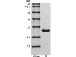 Recombinant Human Interleukin-1 beta GMP