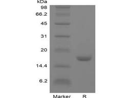 Recombinant Human Interleukin-10 GMP