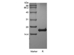 Recombinant Human Interleukin-21 GMP