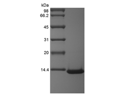 Recombinant Human Monocyte Chemotactic Protein-3/CCL7