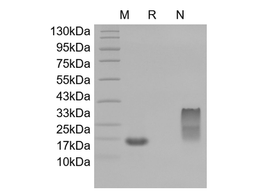 Recombinant Human Monocyte Chemotactic Protein-4/CCL13