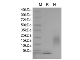 Recombinant Human Hemofiltrate CC Chemokine-1/CCL14