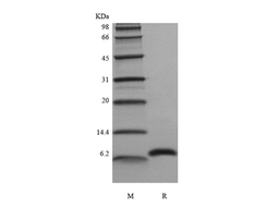 Recombinant Human Hemofiltrate CC Chemokine-1, 66a.a./CCL14