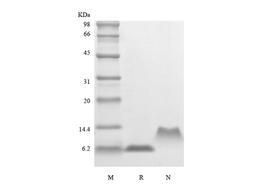 Recombinant Human Macrophage Inflammatory Protein-5, 68a.a./CCL15
