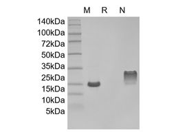 Recombinant Human Thymus Expressed Chemokine/CCL25