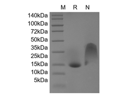 Recombinant Human Mucosae-associated Epithelial Chemokine/CCL28