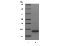 Recombinant Murine CXCL16