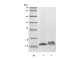 Recombinant Murine Regulation upon Activation Normal T cell Express Sequence/CCL5