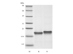 Recombinant Murine Thymus Expressed Chemokine/CCL25