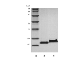Recombinant Rhesus Macaque Regulation upon Activation Normal T cell Express Sequence/CCL5