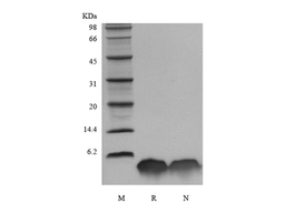 Recombinant Human Parathyroid Hormone 1-34