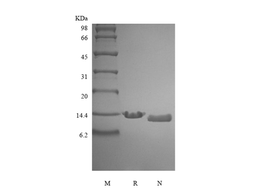 Recombinant Human Parathyroid Hormone 1-84, 15N Stable Isotope Labeled