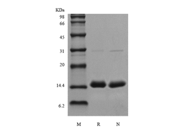 Recombinant Human PCT/Procalcitonin
