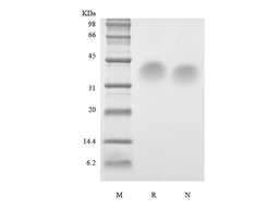 Recombinant Human Parathyroid Hormone 53-84