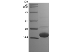 Recombinant Human Cu/Zn Superoxide Dismutase