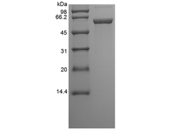 Recombinant Human Protein Disulfide Isomerase