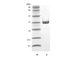 Recombinant Human TP53-induced Glycolysis and Apoptosis Regulator-TAT