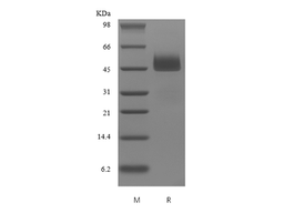 Recombinant Human Neuroserpin