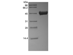 Recombinant Streptokinase