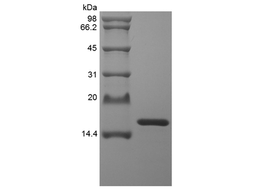 Recombinant Staphylokinase